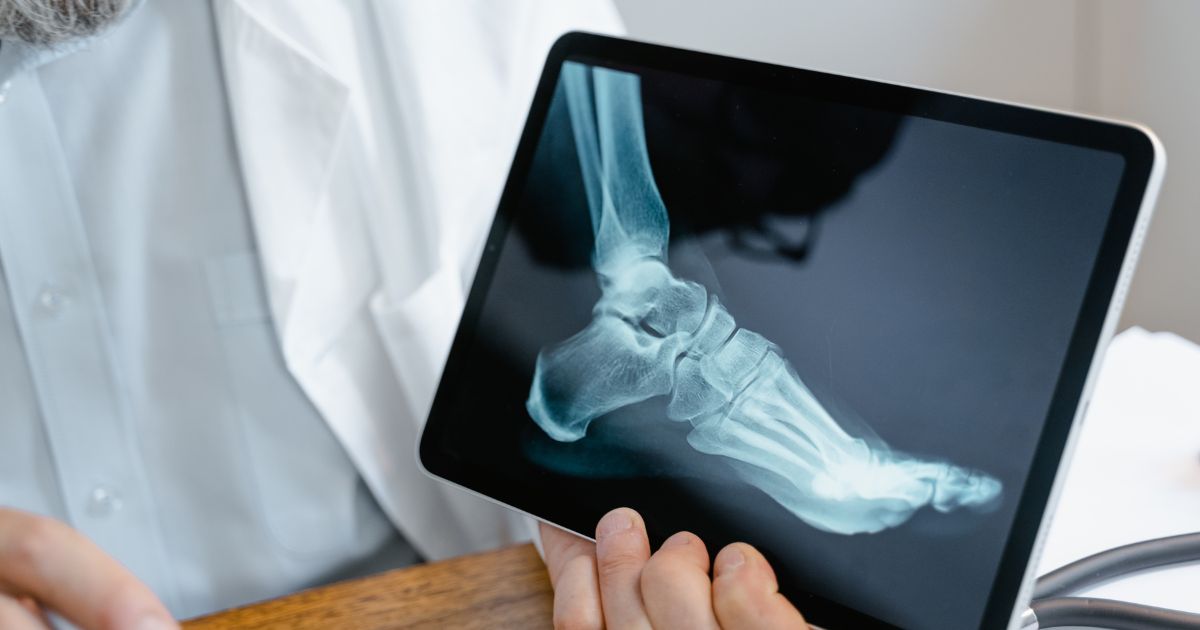 How Are Innovations in Biomaterials Transforming Orthopedic Surgery?